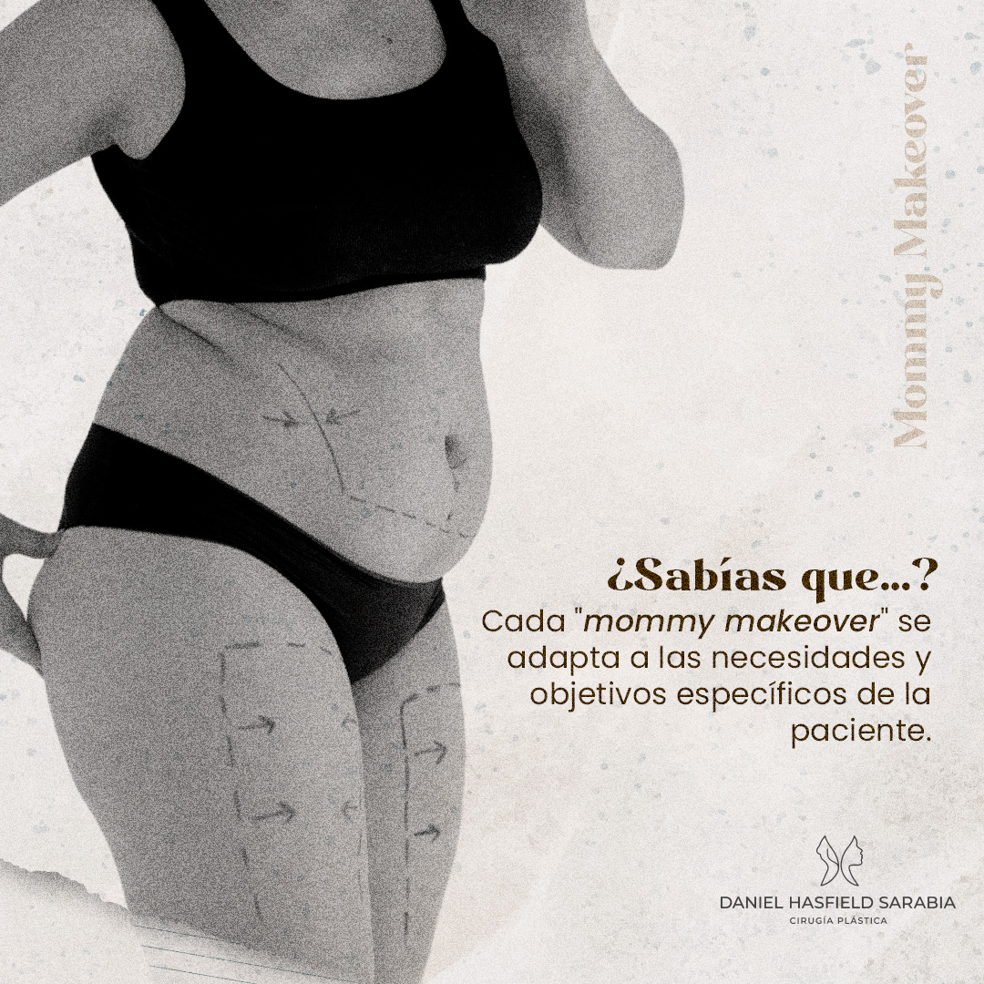 Cada mommy makeover se adapta a las necesidades y objetivos específicos de la paciente