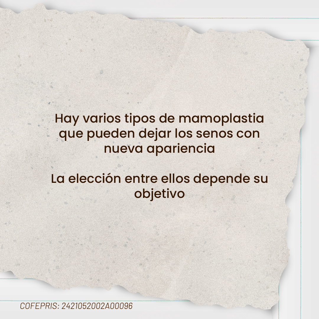 Hay varios tipos de mamoplastia; la elección entre ellos depende de su objetivo