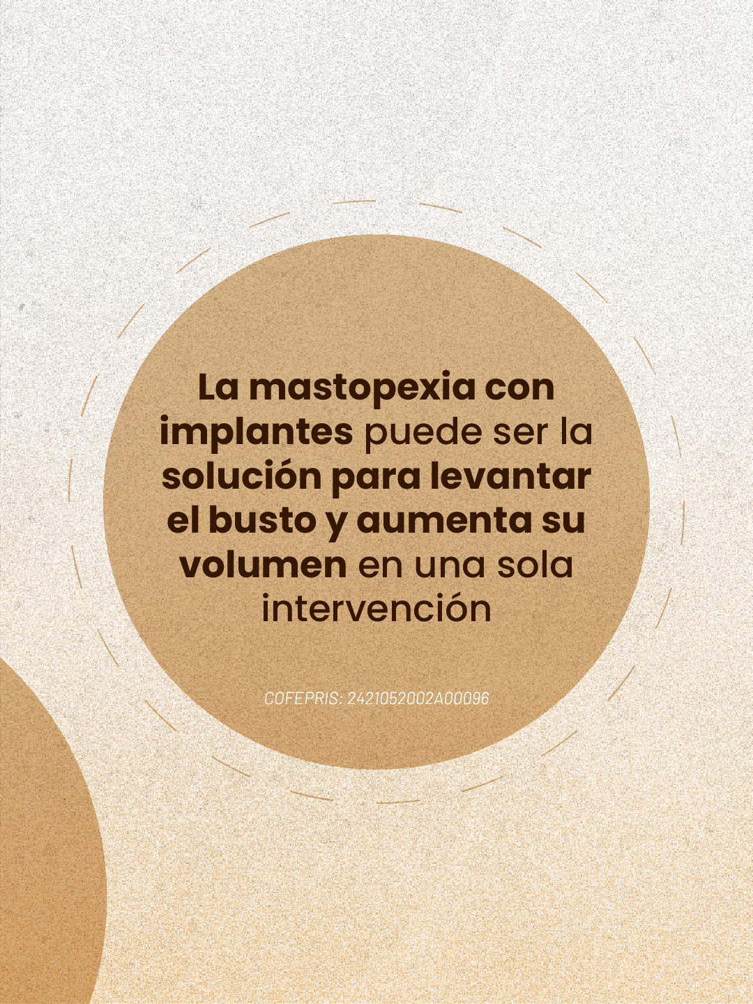 La mastopexia con implantes puede levantar el busto y aumentar su volumen en una sola intervención