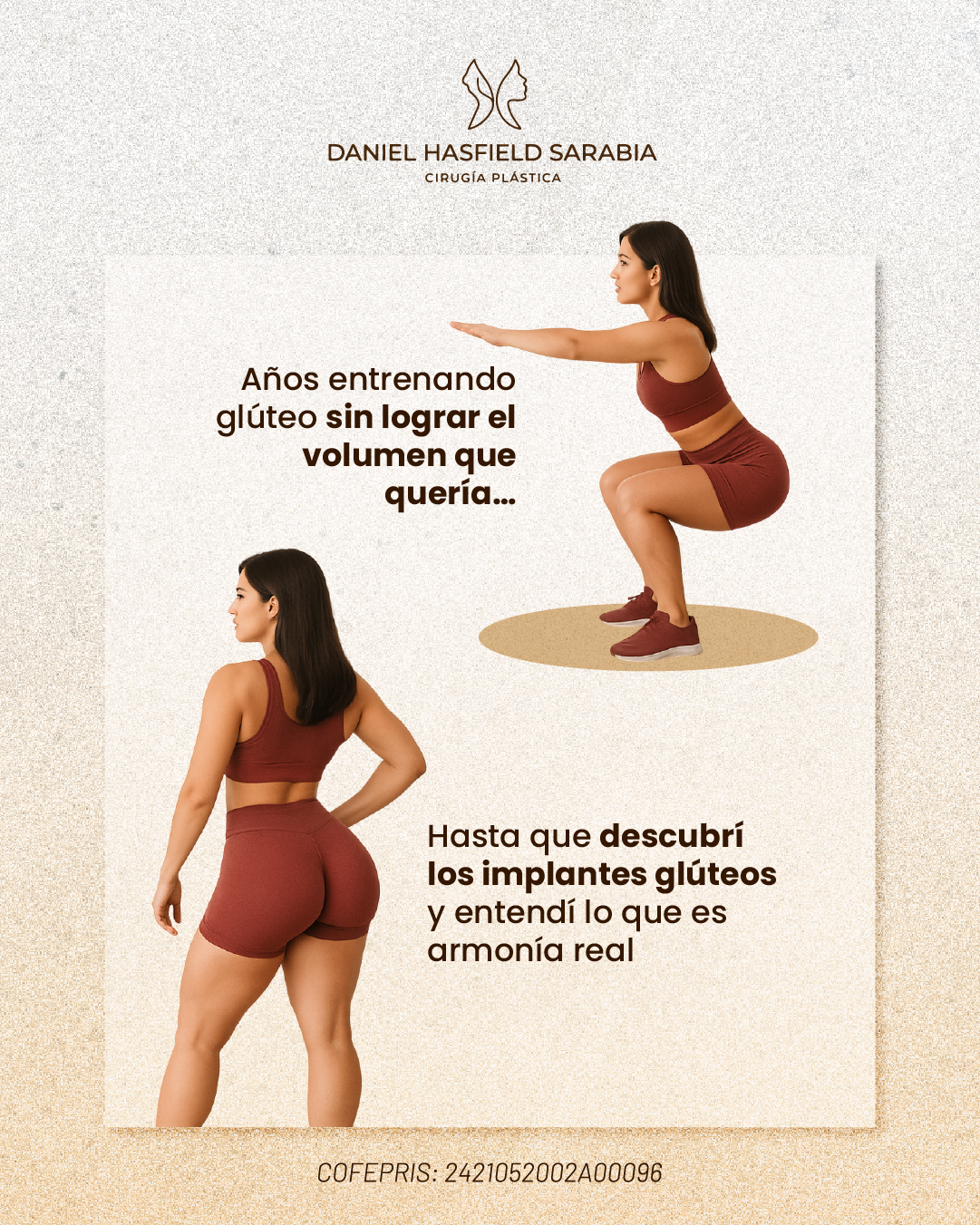 Los implantes glúteos aportan volumen cuando el entrenamiento no lo logra