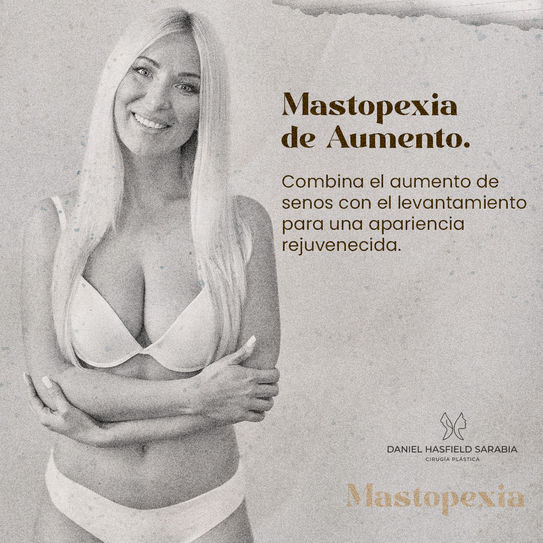 Mastopexia de aumento: combina el aumento de senos con el levantamiento